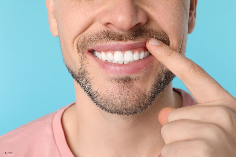 https://www.lajollacosmeticdentistryandorthodontics.com/wp-content/uploads/2023/03/man-pointing-at-his-healthy-teeth.jpg